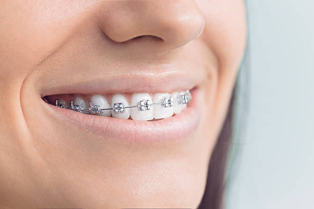 Trusted Parkland, FL Holistic Dental Care Services Experts